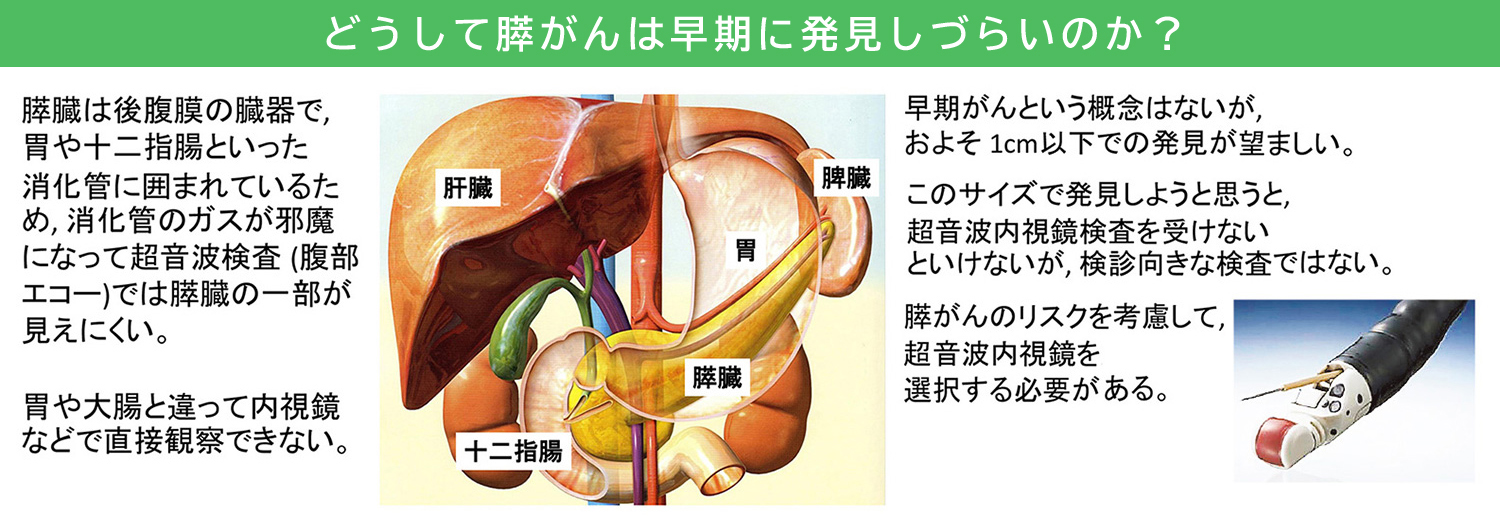 どうして膵がんは早期に発見しづらいのか？