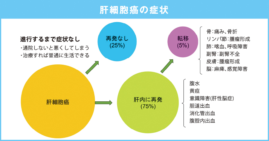 肝細胞癌の症状